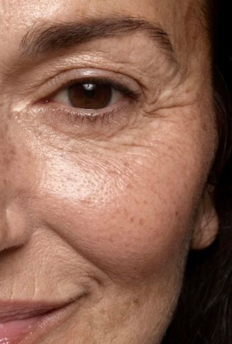 Detalle clínico de textura y líneas finas de la región periocular